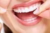 Oral B Superfloss Orthodontic Devices 50 Flosses Produktbild-Vorschau 22