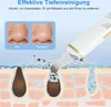 OKWISH Porenreiniger, Electric Mitesserentferner, EMS Produktbild-Vorschau 6