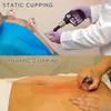 Vakuum Schröpfkopf Set - 12-teiliges Massage Set - Manuelle Produktbild-Vorschau 6