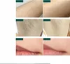 Depilátor Ipl Pro Tělesné Ochlupení Laserové Odstranění Náhled obrázku produktu 14