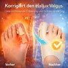 ValgusVital™ Hallux Korrektor Hallux Valgus Bandage Produktbild-Vorschau 5