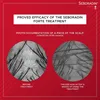 Marketing image showing microscopic views of scalp before and after using Seboradin Forte treatment. Podgląd zdjęcia produktu