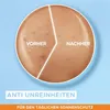 Garnier Ambre Solaire Sensitive Advanced Anteprima dell’immagine prodotto 4
