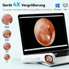Ohrenschmalz Entferner mit Otoskop (1,21" Bildschirm, Produktbild-Vorschau 3