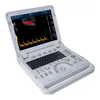 Échographe portable avec sonde linéaire Doppler couleur Voir les images du produit 9