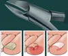 INF Coupe-ongles puissants pour ongles épais et incarnés Le Voir les images du produit 6