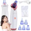 Aspirateur à points noirs, points blancs, pores, boutons, Voir les images du produit 1