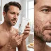 Dermatude Enzyme Peel Produktbild-Vorschau 6