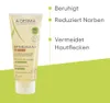 A-Derma Epithelialea.H Massage Massage Gel-Oil Produktbild-Vorschau 7