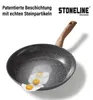 Set di pentole e padelle in Vetroceramica STONELINE®, 14 Anteprima dell’immagine prodotto 5