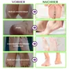 Masque pour les pieds Exfoliant pour les pieds Soin des Voir les images du produit 8
