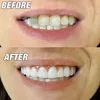 Instant Smile Kit - Dočasná silikónová náhrada zubov 30 ks Náhľad obrázku produktu 3