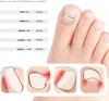 A collage showing a close-up of a toe with a nail correction patch, a size chart with different patch lengths, and illustrations of common toenail problems. Anteprima dell’immagine prodotto