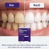 Whitening Strips Zahnaufhellung, 28 Teeth Bleaching Set mit Produktbild-Vorschau 5
