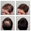 Sibel – Hair Sculptor Hair Building Fibers – Middelbruin Productafbeelding-voorbeeld 2
