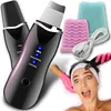 Ultraschallpeelinggerät Gesichtspeeling Skin Scrubber Produktbild-Vorschau 1