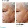 ApricotGold Bio-Lift Gel Produktbild-Vorschau 10