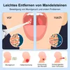 Mandelstein Entferner,3 Geschwindigkeiten,LED Licht,3 Produktbild-Vorschau 3