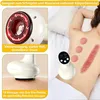 Anti Cellulite Massagegerät elektrisch 4-in-1, Schröpf & Produktbild-Vorschau 5