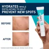 Gel Limpiador Gesichtsbehandlung CeraVe Blemish Control (40 Produktbild-Vorschau 13