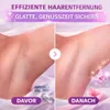 Épilateur Osmo™ EpiLuxe  Épilateur pour femmes Épilation Voir les images du produit 3