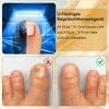 Nagelpilz Laser Behandlungsgerät,Kabelloses Lasergerät des Produktbild-Vorschau 5