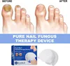 Laserbasierte Nagelpilzbehandlung – Purenail USB - Produktbild-Vorschau 1