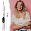 Ultraschall Zahnsteinentferner Smart Mit Led 3 Modi 2 Produktbild-Vorschau 6
