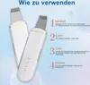 OKWISH Porenreiniger, Electric Mitesserentferner, EMS Produktbild-Vorschau 12