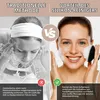 Gesichtsreinigungsbürste 3 Stück Peeling Schwarz Produktbild-Vorschau 4