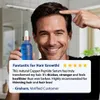 Kupferpeptid (GHK-Cu & AHK-Cu) - Haarwachstumsserum - 30 ml Produktbild-Vorschau 5