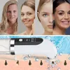 Blackhead-Entferner Vakuum, elektrischer Porenreiniger mit Produktbild-Vorschau 4