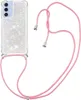 Samsung Galaxy A16 Hülle - Coverup Liquid Glitzer Back Produktbild-Vorschau 2