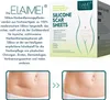 Product packaging and before/after images of scar treatment. Produktbild-Vorschau