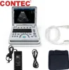CMS1700A-VET Prenosný veterinárny ultrazvukový skener Náhľad obrázku produktu 3