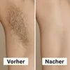 A split image showing before and after hair removal on an underarm. The left side shows significant hair growth, labeled 'Vorher' (Before). The right side shows smooth skin, labeled 'Nacher' (After). Produktbild-Vorschau