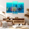 Bild auf Leinwand - Leinwandbild - Bäume Wiese Sommer - Produktbild-Vorschau 7