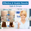 Vysokofrekvenčná tyč Vysokofrekvenčné zariadenie Darsonval Náhľad obrázku produktu 9