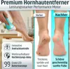 Grundig Hornhautentferner elektrisch Pro - schnell Hornhaut Produktbild-Vorschau 3