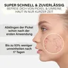 Zinksalbe gegen Pickel | Produktbild-Vorschau 3