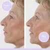 Wrinkle Filler - Sérum Anti-Rides - 15 ml - paquet de 3 Voir les images du produit 2