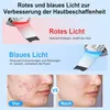 Ultraschall Skin Scrubber, 4 Modi & 4 Stufen mit Rot- und Produktbild-Vorschau 4