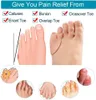 Sumiwish Pinky Toe Separatoren, 8 Packungen Gel-Zehenschutz Produktbild-Vorschau 3