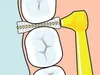 Illustration showing an interdental brush cleaning between teeth, with a yellow handle. Produktbild-Vorschau