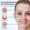 Elektrische Gesichtsreinigungsbürste 3-in-1, Porenreiniger Produktbild-Vorschau 6