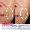 Shark Beauty CryoGlow LED-Maske und Kühlung der Augenpartie Produktbild-Vorschau 5