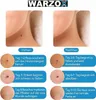 A collage showing the progression of a skin tag removal treatment over 10 days, with before and after images of the affected skin and close-ups of the treatment patches. Podgląd zdjęcia produktu