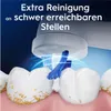 Close-up of a toothbrush head cleaning teeth with plaque. Anteprima dell’immagine prodotto
