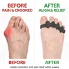 Zehenspreizer Zehentrenner für Hallux Valgus, Hammer‑ und Produktbild-Vorschau 8