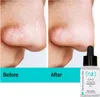 Serum Do Twarzy 30Ml 10% Niacinamide&Zinc Blemish-Soothing/ Podgląd zdjęcia produktu 3